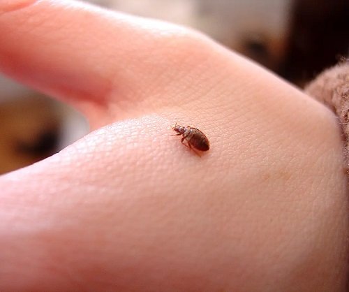 Can Bed Bugs Bite Your Private Areas 1