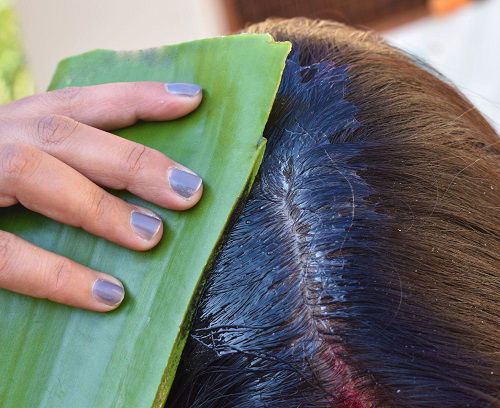 Fascinating Things with an Aloe Plant itchy scalp Care